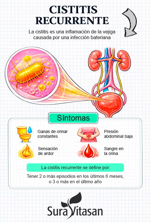 cistitis recurrente síntomas