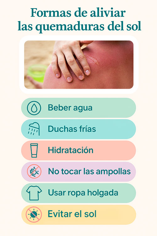 Formas de aliviar las quemaduras del sol