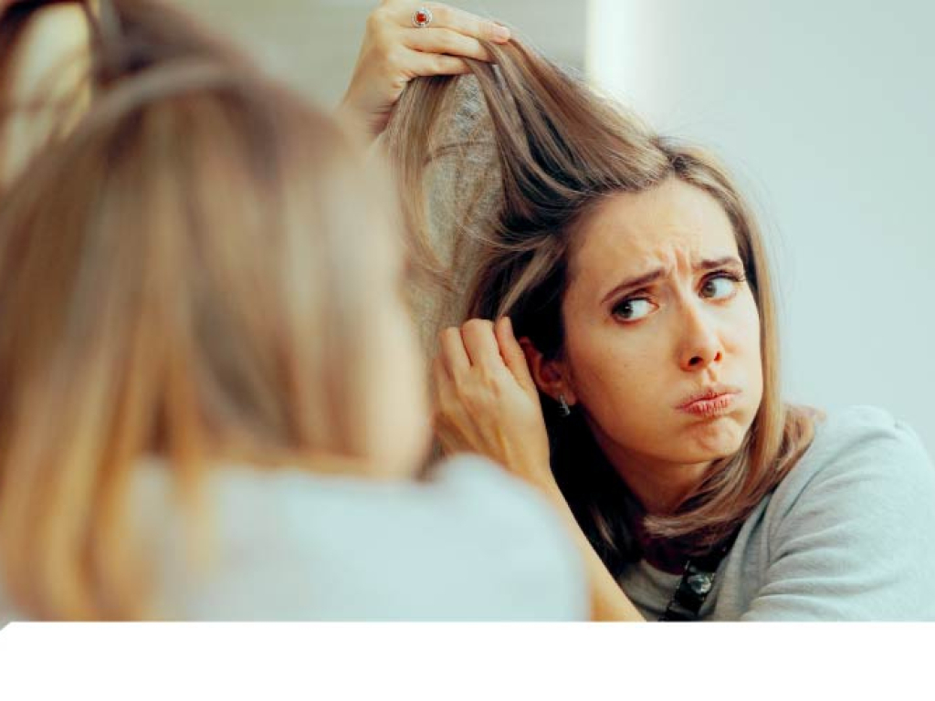 Alopecia androgénica: causas, síntomas y tratamientos Naturales