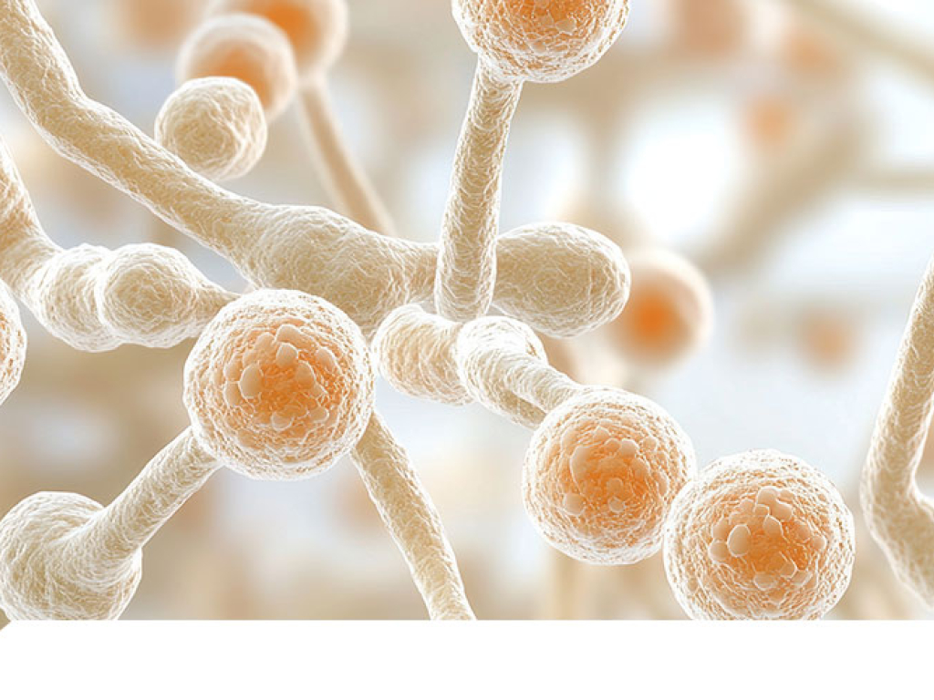 Candidiasis