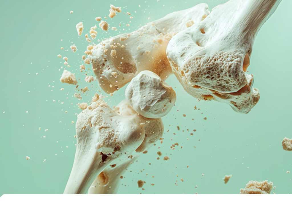 Osteoporosis